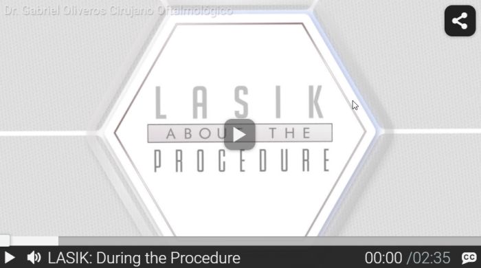 RND - Lasik During the Procedure RND - Lasik What is Lasik