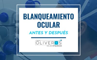Testimonios de Blanqueamiento Ocular