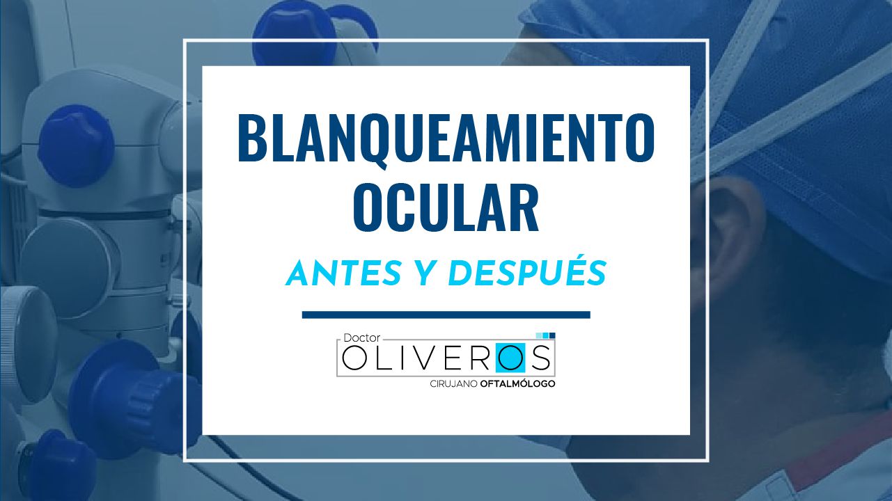 Testimonios - Antes Después - Dr. Gabriel Oliveros